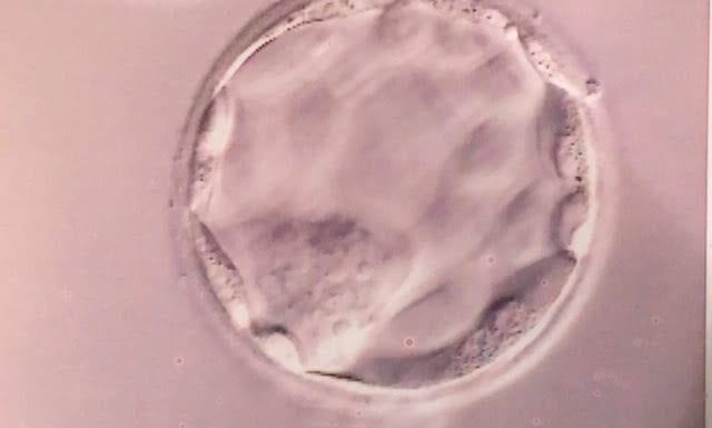 embryo