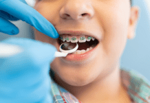 How and When an Orthodontist Can Do Their Best Work