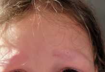 So, Your Kid Shaved Off Their Eyebrows... Don't (Or Try Not To) Panic.