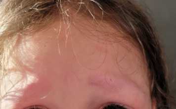 So, Your Kid Shaved Off Their Eyebrows... Don't (Or Try Not To) Panic.